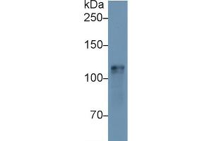 Western Blot; Sample: Mouse Heart lysate; Primary Ab: 1µg/ml Rabbit Anti-Mouse HK1 Antibody Second Ab: 0. (Hexokinase 1 antibody  (AA 137-270))