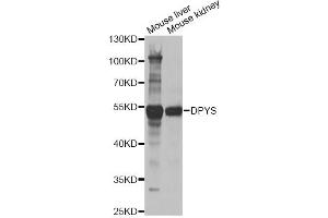 Western blot analysis of extracts of various cell lines, using DPYS antibody (ABIN2562285) at 1:1000 dilution. (DPYS antibody)
