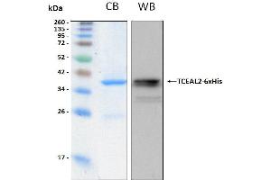 10% SDS-PAGE stained with Coomassie Blue (CB), immunobloting with anti-6xHis monoclonal and peptide fingerprinting by MALDI-TOF mass spectrometry