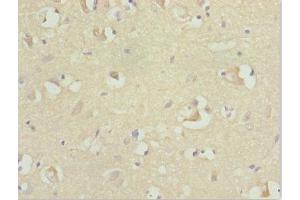 Immunohistochemistry of paraffin-embedded human brain tissue using ABIN7167729 at dilution of 1:100 (RFPL2 antibody  (AA 99-378))