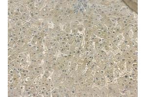 ABIN6257727 and ABIN6274542 at 1/100 staining human normal liver tissue by IHC-P.