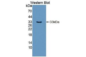 Western blot analysis of the recombinant protein. (SYTL2 antibody  (AA 329-880))