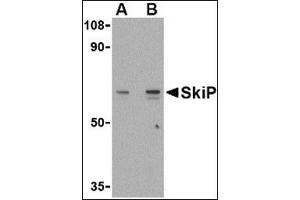 Western blot analysis of SkiP in mouse skeletal muscle tissue lysate with this product at (A) 0. (SKIP (C-Term) antibody)