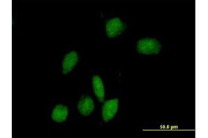 Immunofluorescence of purified MaxPab antibody to ARHGAP9 on HeLa cell. (ARHGAP9 antibody  (AA 1-750))