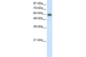 Western Blotting (WB) image for anti-TROVE Domain Family, Member 2 (TROVE2) antibody (ABIN2462169) (TROVE2 antibody)