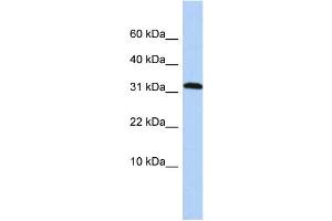 WB Suggested Anti-DYSFIP1 Antibody Titration: 0.