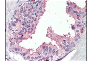 Prostate, Human: Formalin-Fixed, Paraffin-Embedded (FFPE) (SRD5A1 antibody)