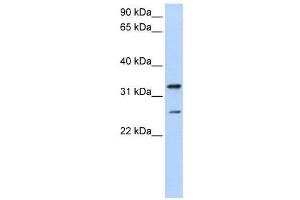 WB Suggested Anti-KCNIP2  Antibody Titration: 0. (KCNIP2 antibody  (N-Term))