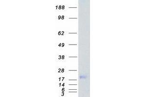 Western Blotting (WB) image for Myosin Light Chain Kinase (MYLK) (Transcript Variant 7) protein (Myc-DYKDDDDK Tag) (ABIN2726683)