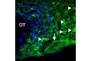 Expression of P2X1 Receptor in rat hypothalamus - Immunohistochemical staining of rat supra-optic nucleus using Anti-P2X1 Receptor Antibody (ABIN7043570, ABIN7045074 and ABIN7045075). (P2RX1 antibody  (Intracellular))