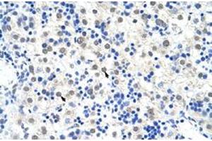 Immunohistochemical staining (Formalin-fixed paraffin-embedded sections) of human liver with DDX47 polyclonal antibody  at 4-8 ug/mL working concentration. (DDX47 antibody  (C-Term))