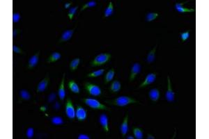 Immunofluorescent analysis of Hela cells using ABIN7169659 at dilution of 1:100 and Alexa Fluor 488-congugated AffiniPure Goat Anti-Rabbit IgG(H+L) (SRPRB antibody  (AA 58-271))