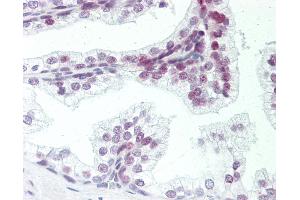 Human Prostate: Formalin-Fixed, Paraffin-Embedded (FFPE). (ZMYM6 antibody  (AA 17-66))