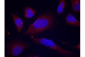 Immunofluorescence (IF) image for anti-Nitric Oxide Synthase 3 (Endothelial Cell) (NOS3) (pSer1177) antibody (ABIN3020412) (ENOS antibody  (pSer1177))