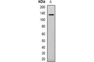 Western blot analysis of Telomerase expression in HepG2 (A) whole cell lysates.