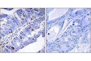 Immunohistochemistry (IHC) image for anti-Nuclear Receptor Subfamily 4, Group A, Member 1 (NR4A1) (AA 317-366), (pSer351) antibody (ABIN1531721)