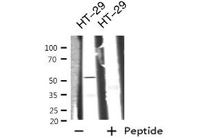 GIPR antibody  (Internal Region)