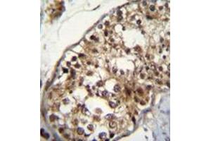 Immunohistochemistry analysis in formalin fixed and paraffin embedded human testis tissue reacted with NUP160 Antibody (Center) followed by peroxidase conjugation of the secondary antibody and DAB staining.