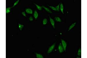 Immunofluorescent analysis of Hela cells using ABIN7176303 at dilution of 1:100 and Alexa Fluor 488-congugated AffiniPure Goat Anti-Rabbit IgG(H+L) (ZFP42 antibody  (AA 6-68))