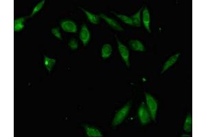 Immunofluorescent analysis of Hela cells using ABIN7176303 at dilution of 1:100 and Alexa Fluor 488-congugated AffiniPure Goat Anti-Rabbit IgG(H+L) (ZFP42 antibody  (AA 6-68))