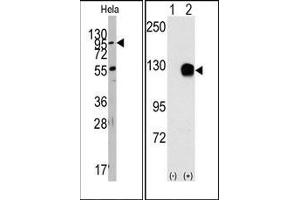 Image no. 1 for anti-TYRO3 Protein Tyrosine Kinase (TYRO3) antibody (ABIN359941) (TYRO3 antibody)