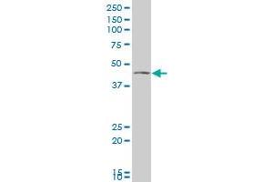 VAT1 polyclonal antibody (A01), Lot # 060608JCS1 Western Blot analysis of VAT1 expression in Jurkat . (VAT1 antibody  (AA 294-392))