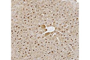 IHC analysis of Alanine Transaminase/Gpt using anti-Alanine Transaminase/Gpt antibody (ABIN7600506). (ALT antibody  (AA 2-496))