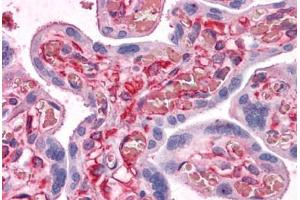 Human Placenta: Formalin-Fixed, Paraffin-Embedded (FFPE) (SHMT1 antibody  (AA 374-483))