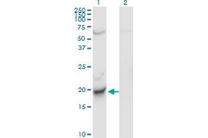 Western Blot analysis of CENPM expression in transfected 293T cell line by C22orf18 monoclonal antibody (M01), clone 4C12-2C8.