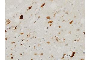 Immunoperoxidase of monoclonal antibody to PTN on formalin-fixed paraffin-embedded human cerebral cortex. (Pleiotrophin antibody  (AA 45-154))