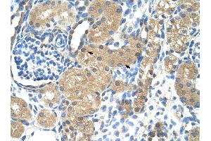Troponin I Type 1 antibody was used for immunohistochemistry at a concentration of 4-8 ug/ml to stain Epithelial cells of renal tubule (arrows) in Human Kidney. (TNNI1 antibody)