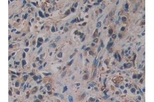 Immunohistochemistry (IHC) image for anti-serpin Peptidase Inhibitor, Clade B (Ovalbumin), Member 6 (SERPINB6) (AA 1-376) antibody (ABIN7441031)