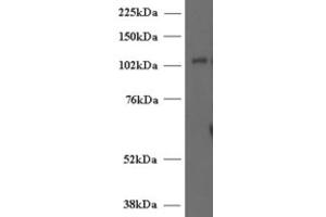 Western Blotting (WB) image for anti-Unc-13 Homolog D (UNC13D) (Internal Region) antibody (ABIN2466419)