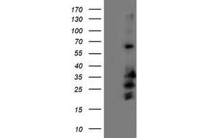 Western Blotting (WB) image for anti-Receptor Accessory Protein 2 (REEP2) antibody (ABIN1500658) (REEP2 antibody)