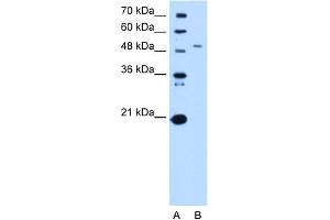 WB Suggested Anti-SPTLC1 Antibody Titration:  0. (SPTLC1 antibody  (Middle Region))