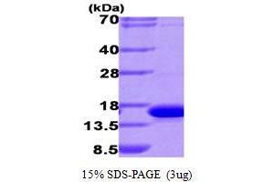 SDS-PAGE (SDS) image for Lectin, Galactoside-Binding, Soluble, 9 (LGALS9) (AA 1-148) protein (His tag) (ABIN667765)