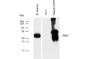 Western blotting analysis of PRR7 using mouse monoclonal antibody TRAP3/10 on rat neuron lysate, and on HeLa transfectants overexpressing human PRR7, compared with non-transfected HeLa cells (negative control). (PRR7 antibody  (C-Term, Intracellular))