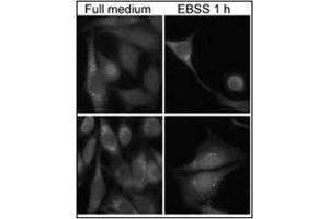 Immunofluorescence staining of Autophagy GABARAP Antibody (N-term) Cat. (GABARAP antibody  (N-Term))