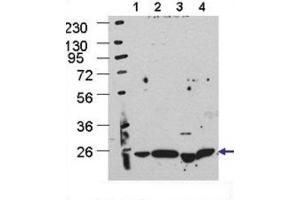 Western Blotting (WB) image for anti-ATG5 Autophagy Related 5 (ATG5) antibody (ABIN2999976) (ATG5 antibody)