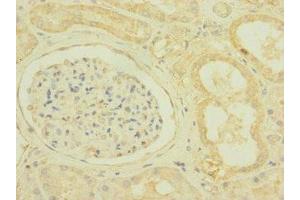 Immunohistochemistry of paraffin-embedded human kidney tissue using ABIN7169925 at dilution of 1:100 (SCN7A antibody  (AA 265-368))