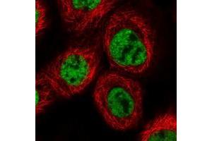 Immunofluorescent staining of human cell line A-431 with PRCC polyclonal antibody  at 1-4 ug/mL dilution shows positivity in nucleus but not nucleoli. (PRCC antibody)