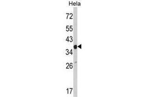 Image no. 1 for anti-Actin Related Protein 2/3 Complex, Subunit 1A, 41kDa (ARPC1A) (C-Term) antibody (ABIN452762) (ARPC1A antibody  (C-Term))