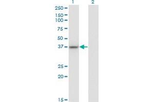 Western Blot analysis of LUC7L expression in transfected 293T cell line by LUC7L monoclonal antibody (M05), clone 2D10.