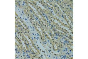 Immunohistochemistry of paraffin-embedded mouse kidney using UBE2I antibody. (UBE2I antibody  (AA 1-158))