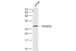 Jurkat lysates probed with PHAPI2 Polyclonal Antibody, Unconjugated  at 1:500 dilution and 4˚C overnight incubation. (ANP32B antibody  (AA 51-150))