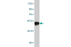 Western Blot detection against Immunogen (35. (CDK8 antibody  (AA 375-464))