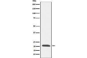 Western blot analysis of DCTN3 expression in SH-SY5Y cell lysate.