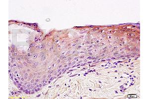 Formalin-fixed and paraffin embedded rat skin tissue labeled with Anti-Integrin beta 1/CD29 Polyclonal Antibody (ABIN669216), Unconjugated at 1:200, followed by conjugation to the secondary antibody and DAB staining (ITGB1 antibody  (AA 25-100))