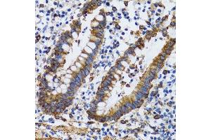 Immunohistochemistry of paraffin-embedded human vermiform appendix using PGRMC1 antibody. (PGRMC1 antibody  (AA 44-195))