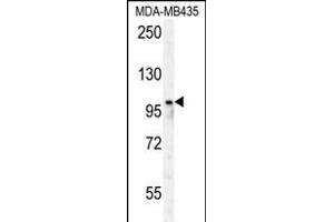RP8 Antibody (Center) (ABIN650978 and ABIN2840019) western blot analysis in MDA-M cell line lysates (35 μg/lane). (PARP8 antibody  (AA 632-660))